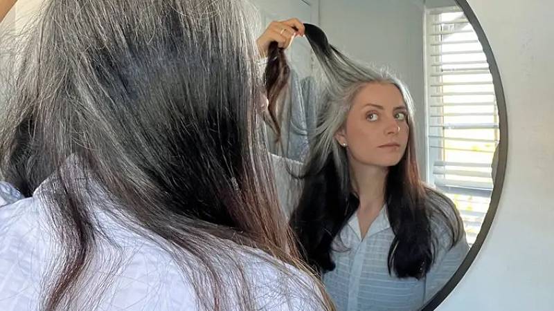 sacin erken beyazlamasinin nedenleri neler eski saclari geri getirmek mumkun mu zPxbJdke.jpg